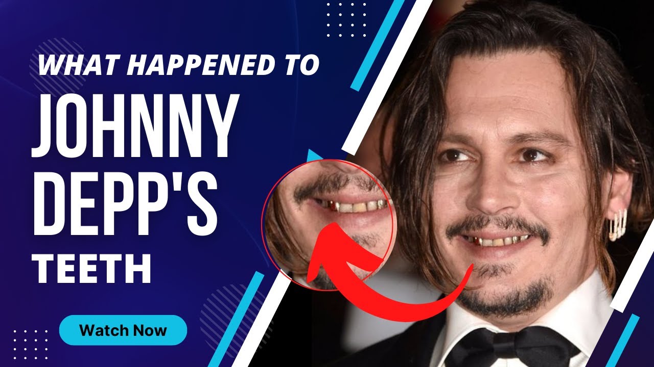 MYSTERY What Happened to Johnny Depp's Teeth? YouTube