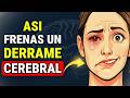 DERRAME CEREBRAL: Tienes 3 HORAS Para Salvar Tu Cerebro (Protocolo FAST)