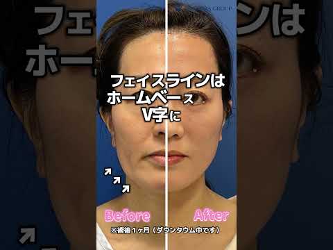 マイナス10歳!最強のアンチエイジング!#shorts