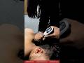 This Treatment Targets Pain at the Source