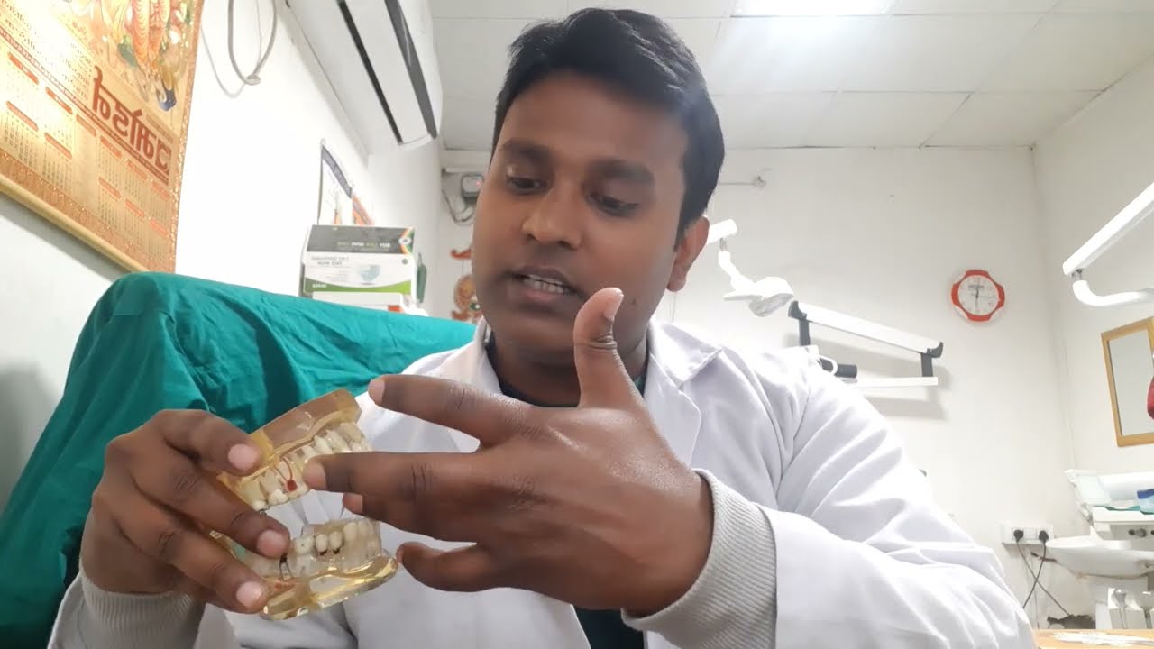 OSMF(oral submucous fibrosis)मुँह नहीं खुलना
