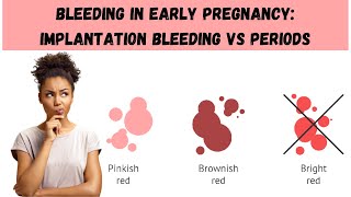 Bleeding in Early Pregnancy: Implantation Bleeding Vs Periods #earlypregnancy #implantationbleeding