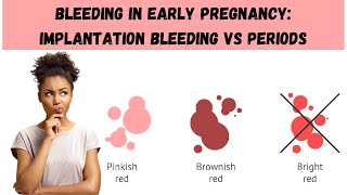 Bleeding in Early Pregnancy: Implantation Bleeding Vs Periods earlypregnancy implantationbleeding