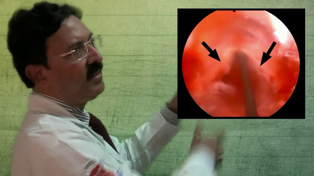 video phone beyonce mp3 7 Surgi talk on DVIU Cutting stricture Technical Variations 2