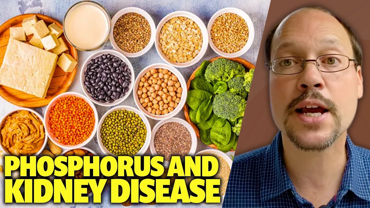 Phosphorus Intake & Kidney Disease. Safe Vegan Foods