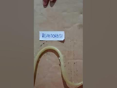 Sistem Ekskresi Dengan Miniataur Urine 