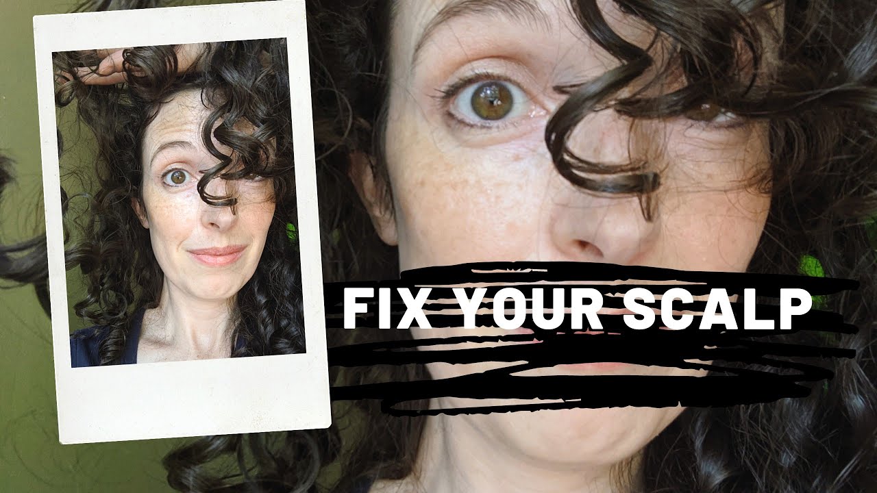 Curly Girl Method: How to Modify for Dandruff and Itchy Oily Scalp ...