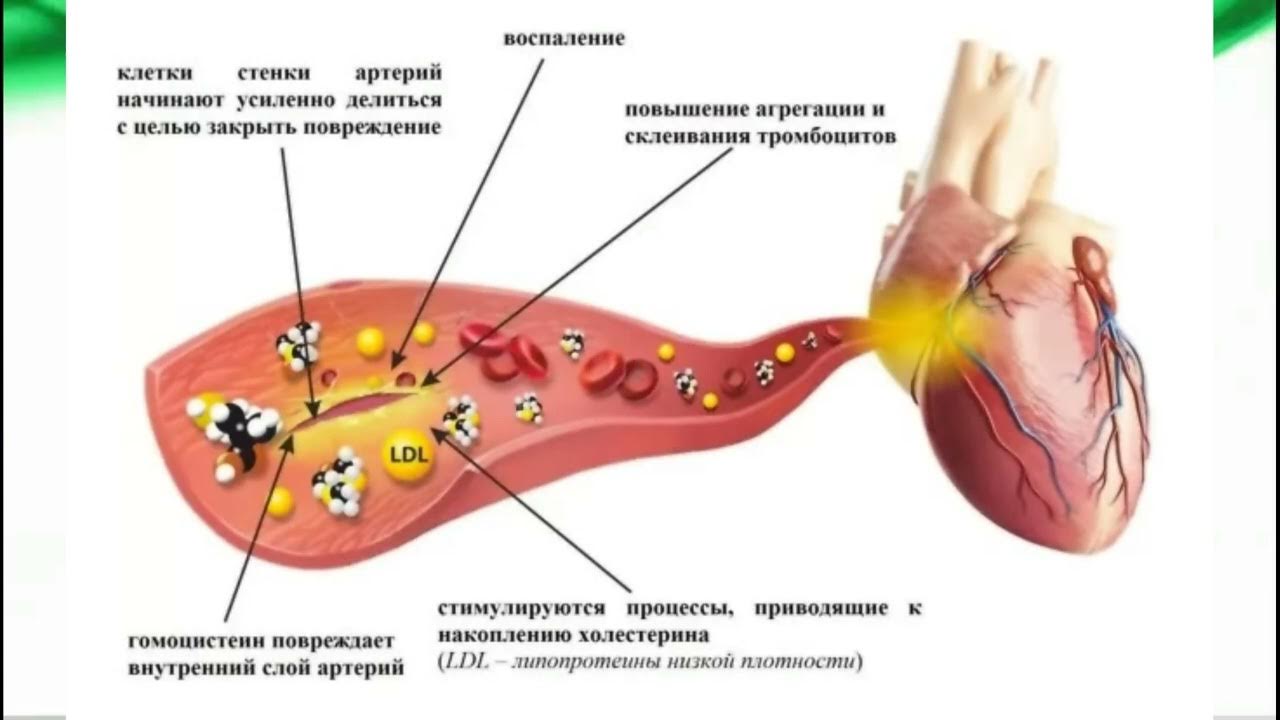Гомоцистеин картинки. Гомоцистеин. Гомоцистеин повреждает сосуды. Цикл фолиевой кислоты. Гомоцистеингомоцистеин.