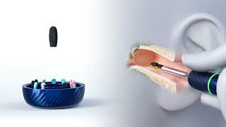 Bebird Note 5 Digital Smart Earwax removal