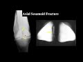 Panel 10 Condylar Surgery