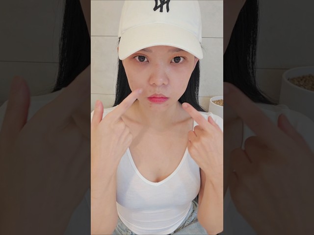 30대 제 피부 상태 심각한 편인가요?
