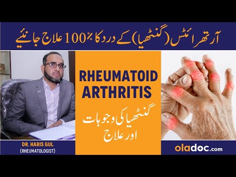 Arthritis Types & Symptoms - Ghantiya Ka Ilaj - Rheumatoid Arthritis Treatment - Joron Ki Sozish thumbnail image