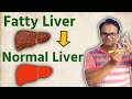 best single acupressure point for fatty liver / dr voll point for fatty liver in hindi / FD 1 point