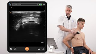 Famous Dynamic Assessment of Ligaments of the Coracoid Process, and Supraspinatus Tendon Net Worth