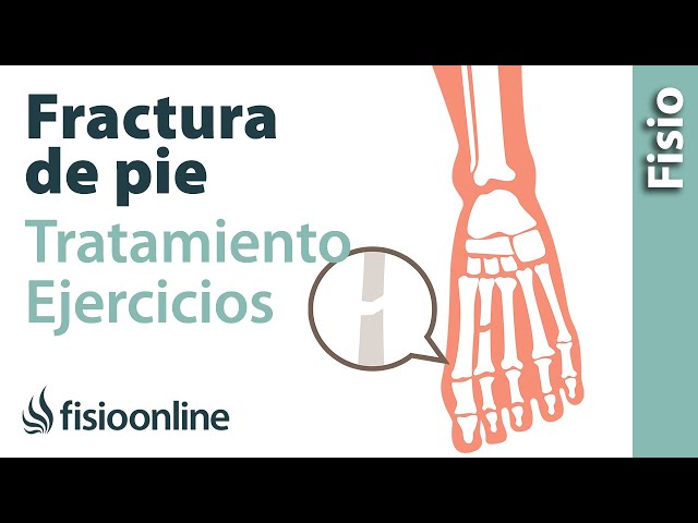 Que diferencia hay entre una fisura y una fractura