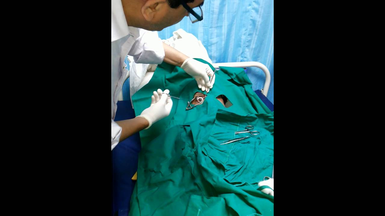 eye-donation-youtube