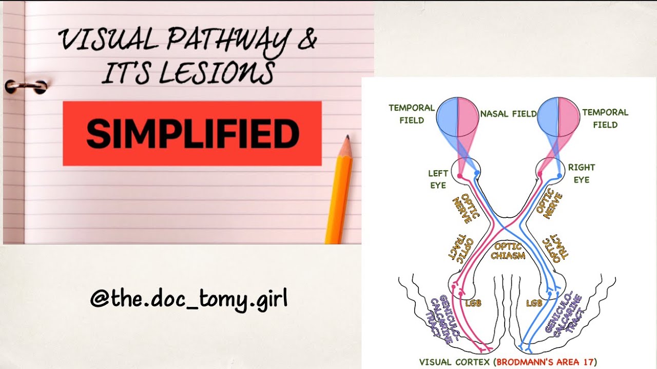 THE VISUAL PATHWAY & It's Lesions Physiology Ophthalmology YouTube
