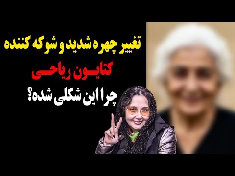 تغییر چهره شوکه کننده کتایون ریاحی که باور نمیکنید چرا این شکلی شده