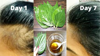 एक बार में बालो का झड़ना रोके और नए बाल उगाएं इस आयुर्वेदिक नुस्खे से  |100% effective & Natural