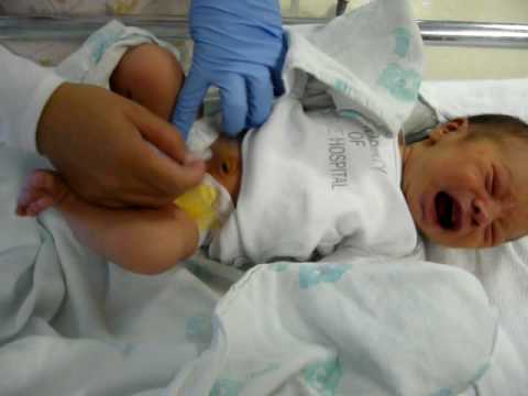 Ethan at Hospital, umbilical cord clamp thingie removal 