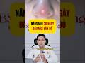 Nâng mũi bị bóng đỏ đầu mũi là do đâu và cần phải làm gì| Bác sĩ nâng mũi đẹp uy tín Hà Nội