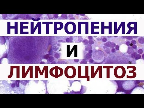 Нейтрофилы понижены лимфоциты повышены. Лейкоцитарная формула крови. Нейтропения Лимфоцитоз.