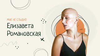 Елизавета: как принять алопецию и найти в ней плюсы?