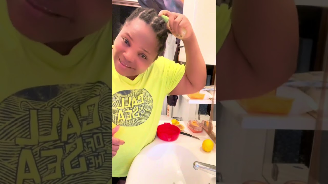 dandruff treatment time #shorts