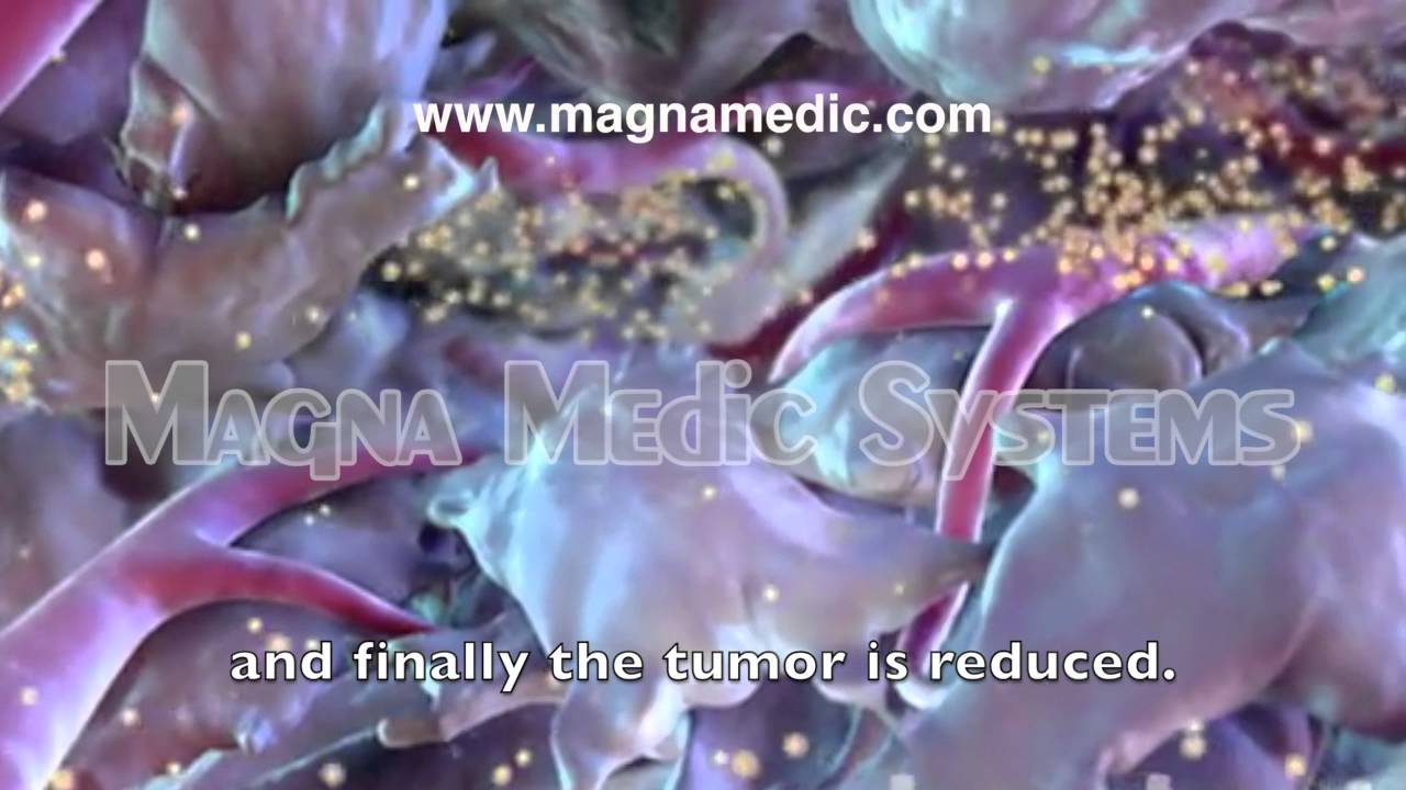 Oncological Hyperthermia treatment Magna Clinic Marbella