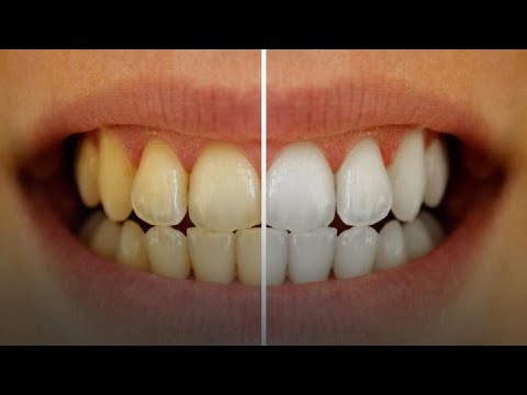 3-hacks-for-the-yellow-to-whiten-teeth-naturally||teeth-clean-tricks||tiktok