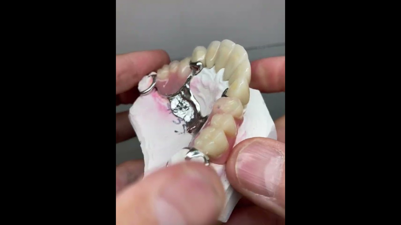 Rhein83 aditamentos de presión ot cap