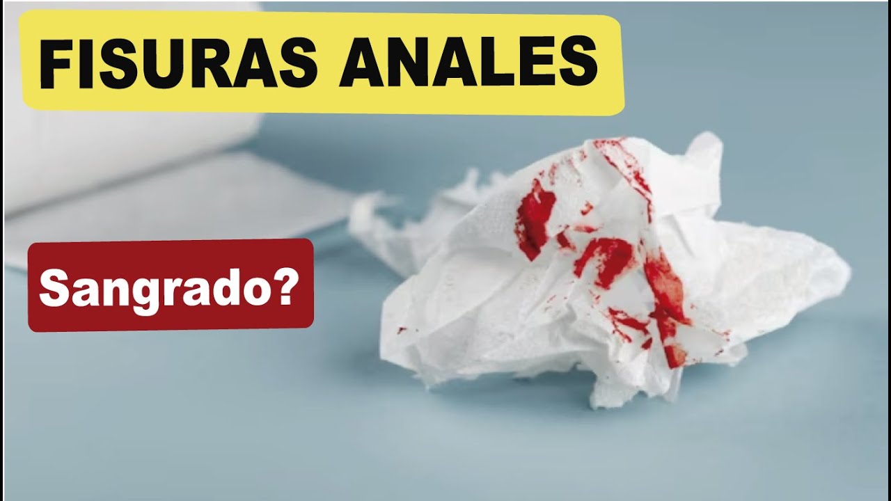 Fisuras Anales - Sangrado en el Ano por ruptura de mucosa - YouTube