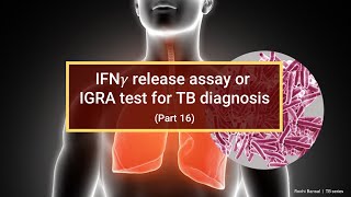 Interferon Gamma Release Assay Test For Mycobacterium Antigens
