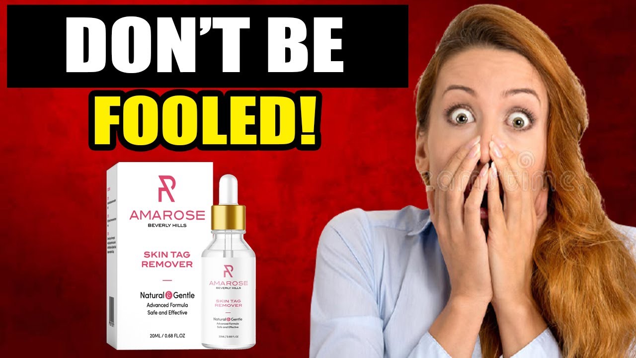 Amarose Skin Tag Remover Review WARNING Does Amarose Skin Tag amarose-skin-tag-remover-review-warning-does-amarose-skin-tag