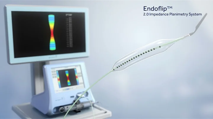 Animation of Endoflip™ Use in the Operating Room