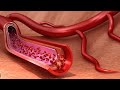 Vassodilator drug ( خلاصة أدوية الضغط ☺)