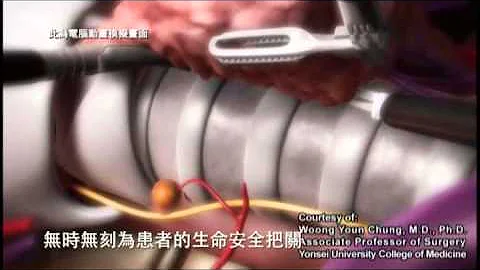 達文西機器手臂機器操作 - 天天要聞