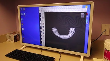Make TMJ splints or bruxism night guards using CT scanner and Phrozen 3D printer