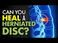 Can You Heal a Herniated Disc?