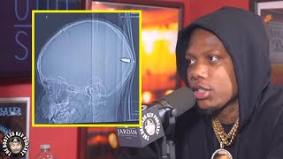 Neek Bucks on Getting Shot in The Head at 17 Years Old