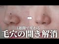 【30代の毛穴悩み解決】つまり・黒ずみ・たるみ毛穴が消えて-5歳若見えする方法!✨