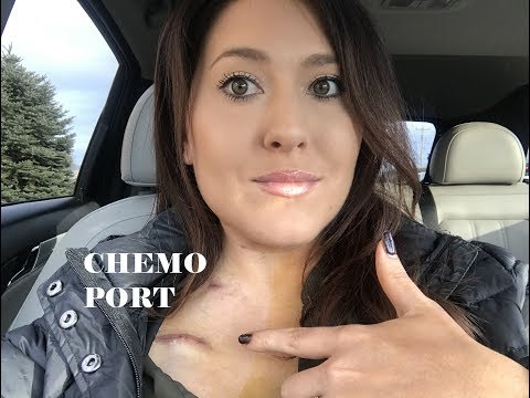 My chemo port procedure, will I feel this?!