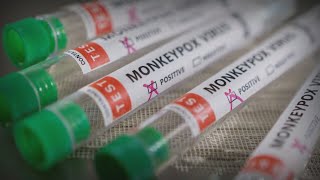 Scientists, healthcare providers prepare next steps in monkeypox public health emergency