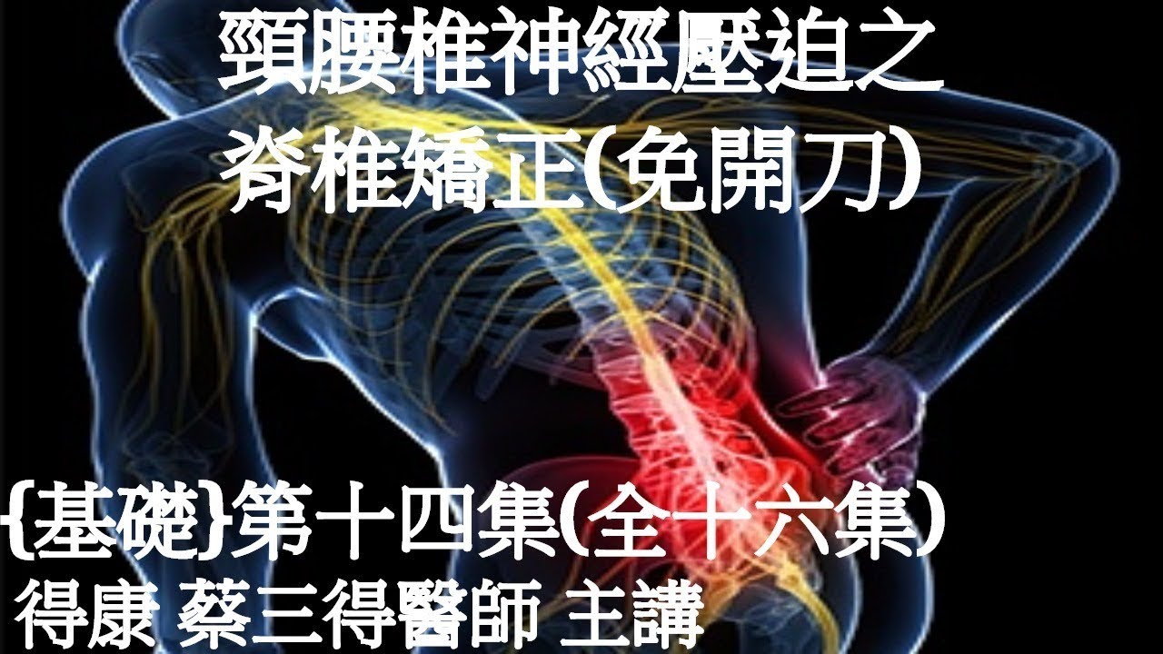 第十四集 頸椎側彎椎間盤突出神經壓迫需開刀 三個案例 Youtube