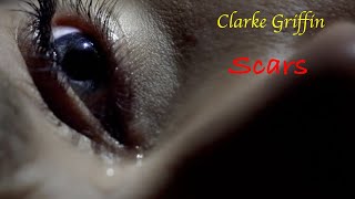Clarke Griffin-Scars