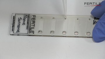 The usage of the "FERTILE" microfluidic sperm sorting chip