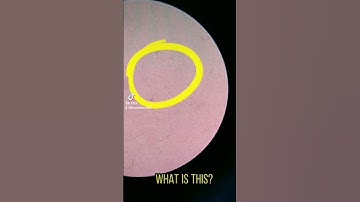 We should store our milk inside the fridge #laboratory #microscope #cls #milk #bacteria #mls #lab