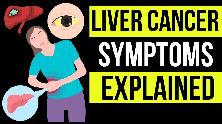 Doctor explains potential SIGNS AND SYMPTOMS of LIVER CANCER | plus causes, prevention & treatment - DayDayNews