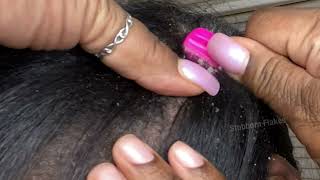 Part 2 Dandruff Removal / Scratch