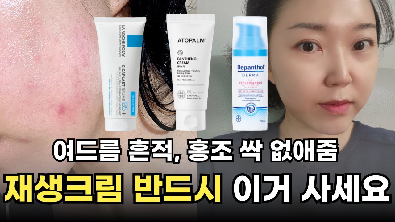 여드름 흉터, 홍조 찐으로 효과 본 재생크림 3가지 추천
